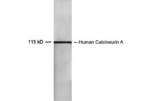Western blot analysis of recombinant human Calcineurin A protein using 0. (Calcineurin A 抗体  (AA 450-500))