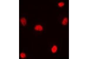 Immunofluorescent analysis of RNF8 staining in MCF7 cells. (RNF8 抗体)