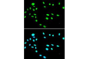 Immunofluorescence analysis of A549 cells using RUVBL1 antibody. (RUVBL1 抗体)