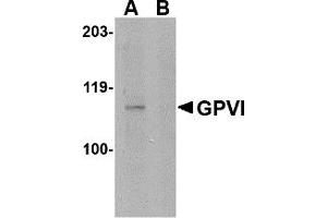 Western Blotting (WB) image for anti-Glycoprotein VI (Platelet) (GP6) (Middle Region) antibody (ABIN1030943) (GP6 抗体  (Middle Region))