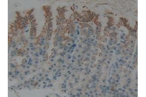 Detection of CK5 in Rat Stomach Tissue using Polyclonal Antibody to Cytokeratin 5 (CK5) (Cytokeratin 5 抗体  (AA 335-473))