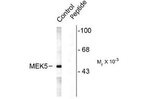 Image no. 1 for anti-Mitogen-Activated Protein Kinase Kinase 5 (MAP2K5) (pSer311), (pThr315) antibody (ABIN372667) (MAP2K5 抗体  (pSer311, pThr315))