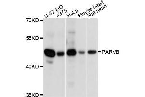 Western blot analysis of extracts of various cell lines, using PARVB antibody. (Parvin, beta 抗体)