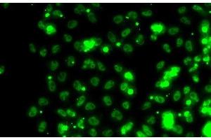 Immunofluorescence analysis of HeLa cells using SECISBP2 Polyclonal Antibody (SECISBP2 抗体)