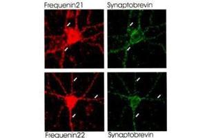 Hippocampal neurons were prepared from 17 d old NMRI mice and grown as described previously (G.