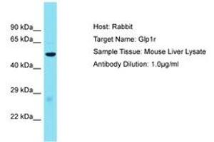 Image no. 1 for anti-Glucagon-Like Peptide 1 Receptor (GLP1R) (AA 101-150) antibody (ABIN6750508) (GLP1R 抗体  (AA 101-150))