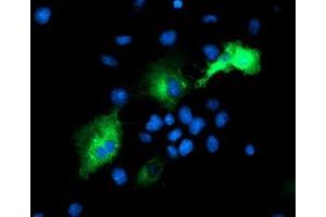 Anti-PSMD2 mouse monoclonal antibody (ABIN2454812) immunofluorescent staining of COS7 cells transiently transfected by pCMV6-ENTRY PSMD2 (RC203204). (PSMD2 抗体)