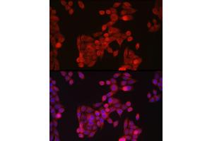 Immunofluorescence analysis of HeLa cells using ZIP14 Rabbit pAb (ABIN6133191, ABIN6147993, ABIN6147994 and ABIN6214658) at dilution of 1:100 (40x lens). (SLC39A14 抗体  (AA 240-340))