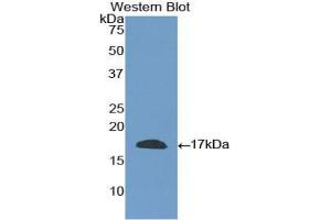 Western blot analysis of the recombinant protein. (CD40 Ligand 抗体  (AA 180-261))