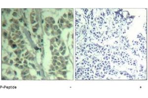 Image no. 2 for anti-Cas-Br-M (Murine) Ecotropic Retroviral Transforming Sequence (CBL) (pTyr700) antibody (ABIN319293) (CBL 抗体  (pTyr700))