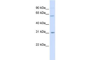 WB Suggested Anti-CHST2 Antibody Titration:  0. (CHST2 抗体  (Middle Region))