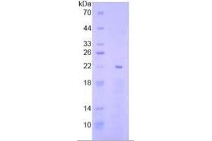 SDS-PAGE of Protein Standard from the Kit  (Highly purified E. (EGR1 ELISA 试剂盒)