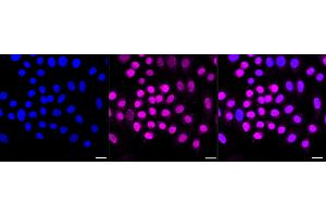 Immunocytochemical staining of HepG2 cells with Cyclin dependent kinase 1 antibody (ABIN7798207), 1:1,000).
