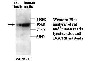 Image no. 1 for anti-DiGeorge Syndrome Critical Region Gene 8 (DGCR8) antibody (ABIN790956) (DGCR8 抗体)