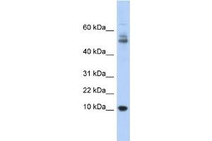 WB Suggested Anti-MTPN Antibody Titration: 0. (MTPN 抗体  (Middle Region))