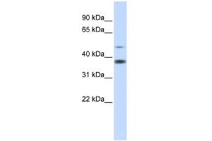 WB Suggested Anti-C2orf25 Antibody Titration: 0. (MMADHC 抗体  (Middle Region))