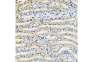 Immunohistochemistry of paraffin-embedded mouse kidney using C4BPB antibody at dilution of 1:100 (40x lens).