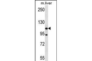 ADNP2 Antibody (Center) (ABIN657902 and ABIN2846853) western blot analysis in mouse liver tissue lysates (35 μg/lane).