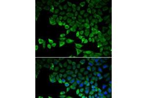 Immunofluorescence analysis of HeLa cells using RIG-I / DDX58 Polyclonal Antibody (DDX58 抗体)