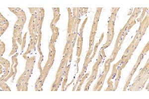 Immunohistochemistry (IHC) image for anti-Myosin Heavy Chain 1, Skeletal Muscle, Adult (MYH1) (AA 1585-1642) antibody (ABIN7432535)