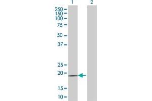 Western Blotting (WB) image for CD53 293T Cell Transient Overexpression Lysate(Denatured) (ABIN1331266)