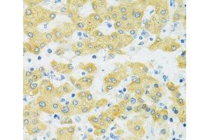 Immunohistochemistry (Paraffin-embedded Sections) (IHC (p)) image for anti-Solute Carrier Family 37 (Glucose-6-Phosphate Transporter), Member 4 (SLC37A4) antibody (ABIN7257962)