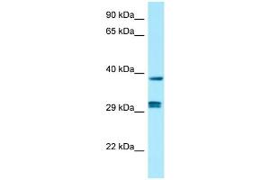 Western Blotting (WB) image for anti-Protein Phosphatase 1, Catalytic Subunit, beta Isoform (PPP1CB) (C-Term) antibody (ABIN2790275)