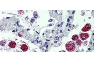 IHC Information:  Lung, Human: Formalin-Fixed, Paraffin-Embedded (FFPE) (CYBB 抗体  (C-Term))