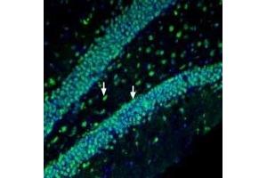Immunohistochemistry (IHC) image for anti-Prostaglandin F Receptor (FP) (PTGFR) (AA 233-246) antibody (ABIN7043565)