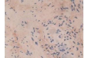 Immunohistochemistry (IHC) image for anti-Collagen, Type VI, alpha 3 (COL6a3) (AA 463-624) antibody (ABIN7434719)