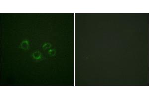 Immunofluorescence analysis of A549 cells, using EPHA2/3/4 (Ab-588/596) antibody. (EPHA2/3/4 抗体)