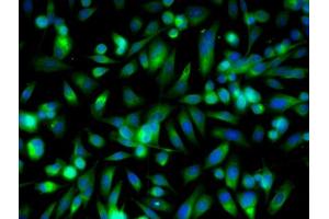 Image provided by One World Lab validation program. (Retinoic Acid Receptor beta 抗体  (AA 155-250))
