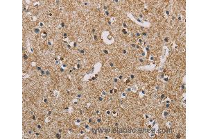 Immunohistochemistry of Human brain  using PIP4K2A Polyclonal Antibody at dilution of 1:50 (PIP4K2A 抗体)
