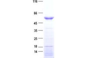 Validation with Western Blot