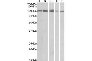 ABIN768646 (0. (SIDT1 抗体  (AA 334-347))