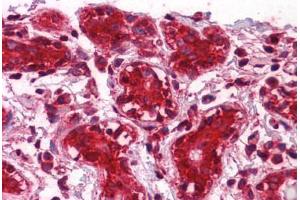 Human Breast: Formalin-Fixed, Paraffin-Embedded (FFPE) (CLIC1 抗体  (AA 1-242))