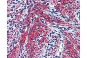 POSTN antibody was used for immunohistochemistry at a concentration of 4-8 ug/ml. (Periostin 抗体  (N-Term))