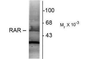 Western Blotting (WB) image for anti-Retinoic Acid Receptor, alpha (RARA) (N-Term) antibody (ABIN371837) (Retinoic Acid Receptor alpha 抗体  (N-Term))