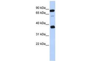 Image no. 1 for anti-B-Cell Receptor-Associated Protein 29 (BCAP29) (AA 209-258) antibody (ABIN6743315) (BCAP29 抗体  (AA 209-258))