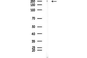 anti-ATP-Binding Cassette, Sub-Family A (ABC1), Member 4 (ABCA4) (C-Term) antibody