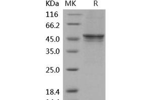 Western Blotting (WB) image for Glycogen Synthase Kinase 3 beta (GSK3b) (Active) protein (His tag) (ABIN7317117) (GSK3 beta Protein (His tag))