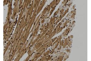 ABIN6265365 and ABIN6273325 at 1/100 staining Mouse heart tissue by IHC-P. (SUGT1 抗体  (C-Term))