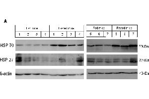 Western Blotting (WB) image for anti-Heat Shock Protein 70 (HSP70) antibody (ABIN361708)