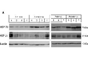 Western blot analysis of heat shock protein expression in fasted mouse livers.