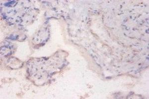Immunohistochemistry of paraffin-embedded human placenta tissue using ABIN7168200 at dilution of 1:100 (RPS6KB2 抗体  (AA 1-210))