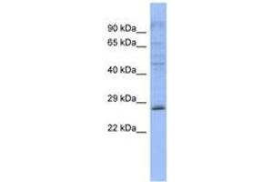 Image no. 1 for anti-Pleckstrin Homology Domain Containing, Family B (Evectins) Member 2 (PLEKHB2) (AA 143-192) antibody (ABIN6743268) (PLEKHB2 抗体  (AA 143-192))