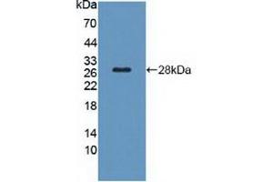 Figure. (TSH receptor 抗体  (AA 28-245))