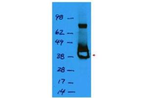 Western blot using  affinity purified anti-Lac I antibody shows detection of a 38 kDa band corresponding to recombinant Lac I (arrowhead). (LacI 抗体)