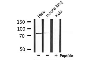 Western blot analysis of extracts from Hela and mouse lung, using SLC9A7 Antibody. (NHE7 抗体  (Internal Region))