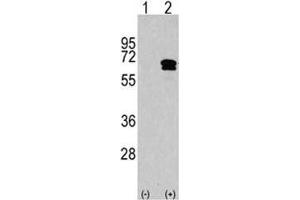 Western blot analysis of CAMKK2 antibody and 293 cell lysate either nontransfected (Lane 1) or transiently transfected with the CAMKK2 gene (2). (CAMKK2 抗体  (AA 483-512))